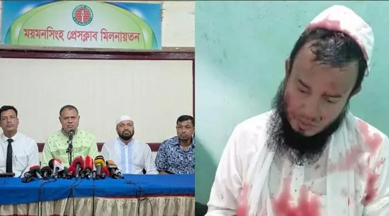 মুরগির রক্ত শরীরে লাগিয়ে বিএনপির ওপর হামলার অভিযোগ পরাজিত প্রার্থীর