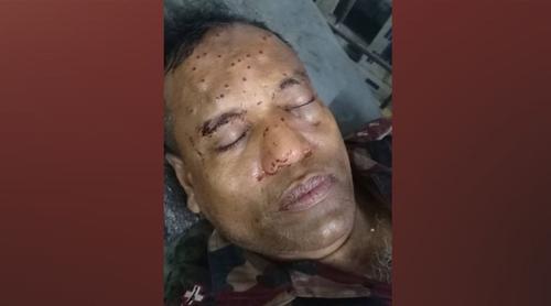 ঠাকুরগাঁওয়ের সীমান্তে বিএসএফের গুলিতে বিজিবি সদস্য আহত