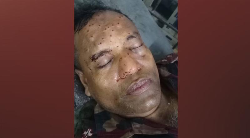 ঠাকুরগাঁওয়ের সীমান্তে বিএসএফের গুলিতে বিজিবি সদস্য আহত