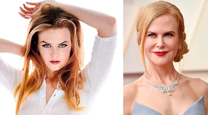 হাসপাতালে হলিউড অভিনেত্রী নিকোল কিডম্যান