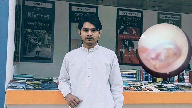 ছাত্রদলের মারধরে ফেটে গেছে ঢাবির হল সংসদ নেতার কানের পর্দা