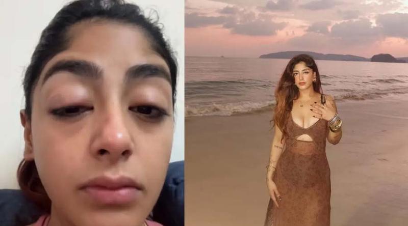 স্প্লিটসভিলা-১৬ খ্যাত প্রীতের উপর হামলার অভিযোগ