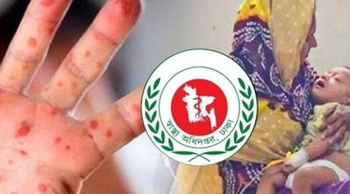 হাম ও হামের উপসর্গে আরও ৯ শিশুর মৃত্যু