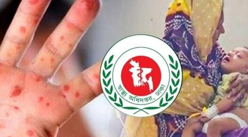 হাম ও হামের উপসর্গে আরও ৯ শিশুর মৃত্যু