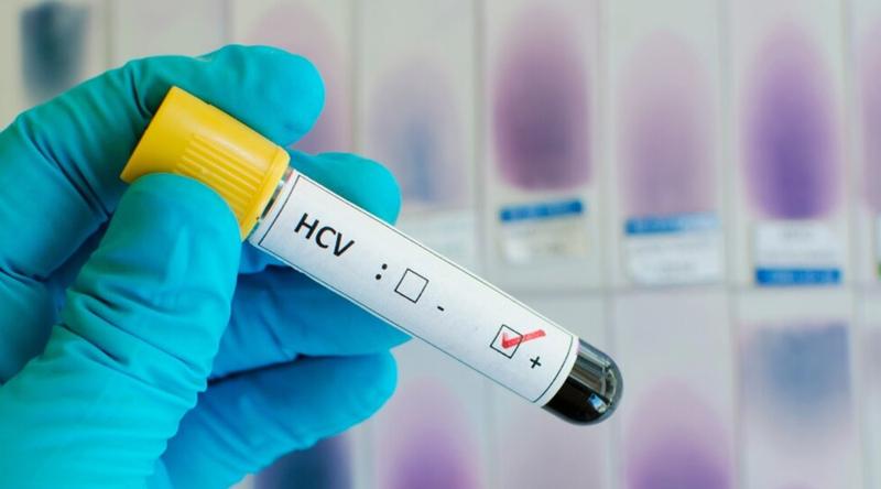 এক বছরে বিশ্বজুড়ে হেপাটাইটিস বি কমেছে ৩২ শতাংশ