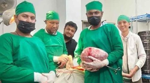 ৬৫ বছরের নারীর পেট থেকে বের হলো সাড়ে ৬ কেজির টিউমার