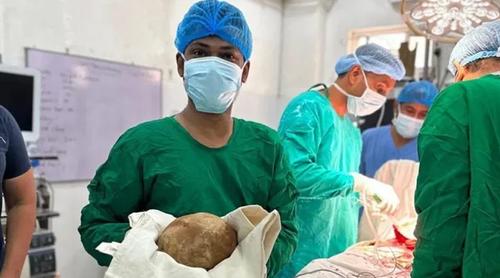 মূত্রথলি থেকে বের হলো দানবাকৃতির ৩.১ কেজির পাথর