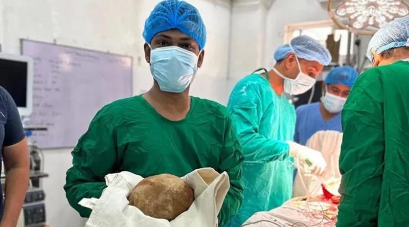 মূত্রথলি থেকে বের হলো দানবাকৃতির ৩.১ কেজির পাথর