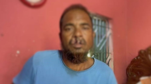 ফরিদপুরের সালথায় বিএনপি নেতার দাঁত ভেঙে দিলেন আ.লীগ সমর্থকরা