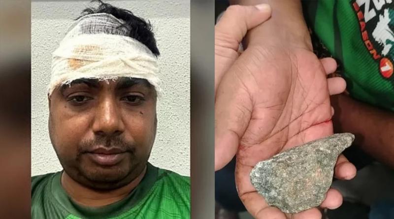 চলন্ত ট্রেনে পাথর নিক্ষেপ, মাথা ফাটল কক্সবাজার এক্সপ্রেসের যাত্রীর