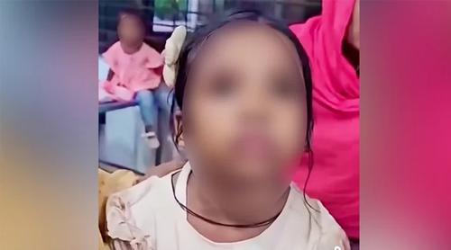 বিড়ালের আঁচড়ের পর শিশুর ‘মিউ মিউ’ শব্দ, কারণ জানালেন চিকিৎসক