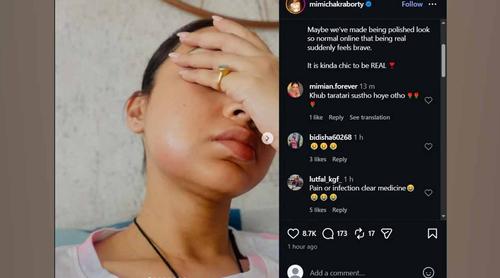 হঠাৎ বদলে গেল চেহারা, কী হয়েছে ‘দুষ্টু কোকিল’ মিমির?