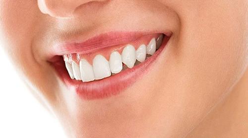 দাঁতের যত্ন না নিলে কী ঘটতে পারে?