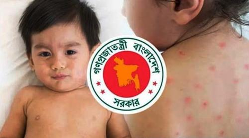 হাম উপসর্গে ঝরে গেল আরও ৫ প্রাণ, মোট মৃত্যু ৮২৫