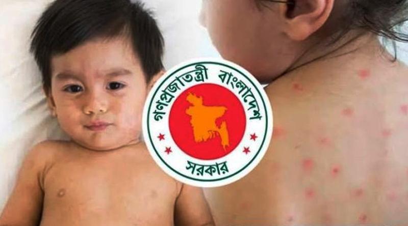 হাম উপসর্গে ঝরে গেল আরও ৫ প্রাণ, মোট মৃত্যু ৮২৫