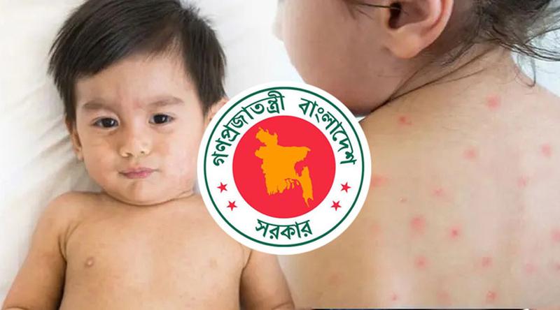 হামের উপসর্গে আরও ৬ শিশুর মৃত্যু