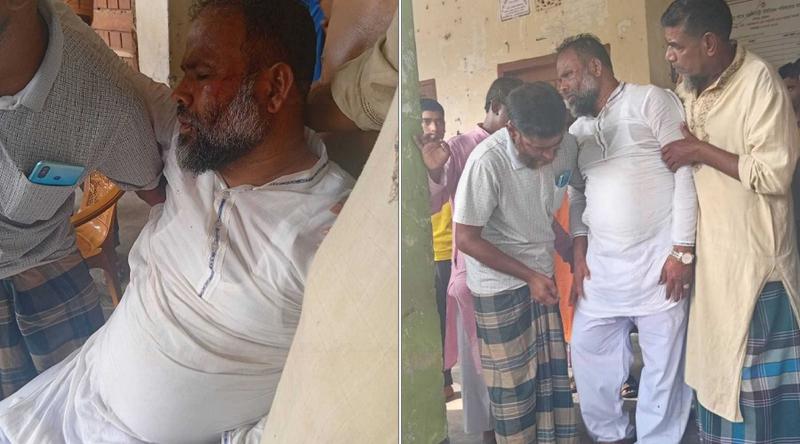 ভিজিএফের চালের তালিকা নিয়ে দ্বন্দ্ব, ইউপি চেয়ারম্যানের ওপর হামলা