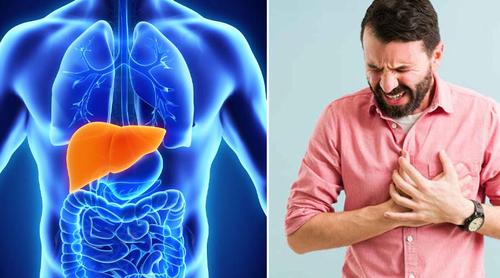 ফ্যাটি লিভার দূর করার প্রাকৃতিক উপায়