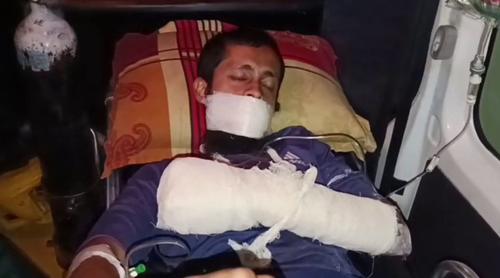 গোপালগঞ্জে ককটেল বানাতে গিয়ে যুবক আহত