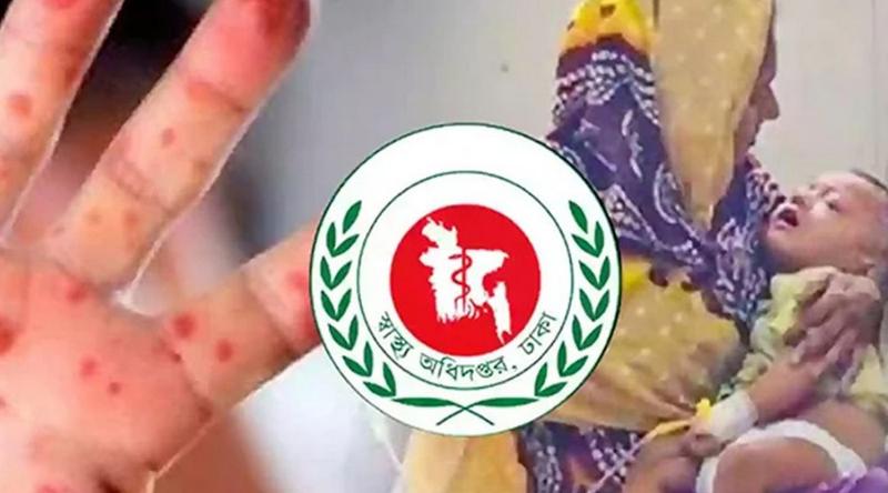 বরিশালে হাম উপসর্গে আরও এক শিশুর মৃত্যু