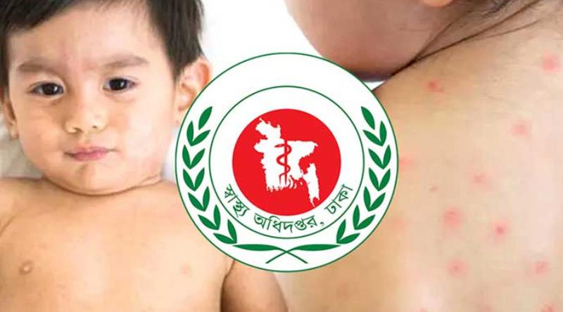 হাম ও উপসর্গে প্রাণ গেল আরও ৯ শিশুর