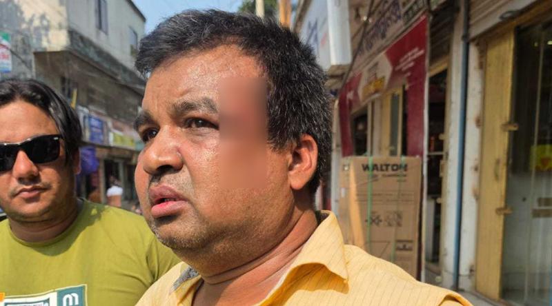 ভুয়া কর্মকর্তা সন্দেহে ভ্যাট পরিদর্শককে মারধর