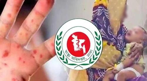 হাম-উপসর্গে প্রাণ গেল আরও ১৩ শিশুর