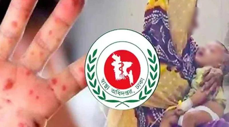 হাম-উপসর্গে প্রাণ গেল আরও ১৩ শিশুর
