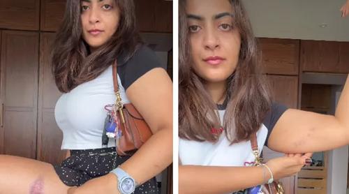 পুলিশি হেনস্তার অভিযোগ এনে সরব আমিরের ভাইঝি