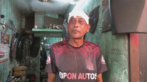 নিজ বাড়ির সামনে হামলার শিকার অভিনেতা সমু চৌধুরী, মাথায় ৪ সেলাই