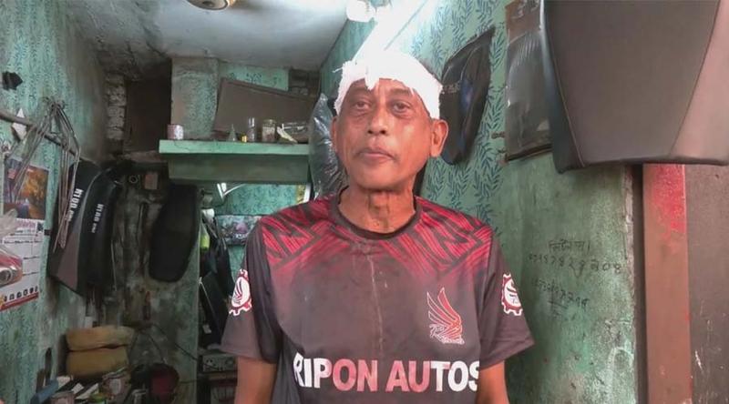 নিজ বাড়ির সামনে হামলার শিকার অভিনেতা সমু চৌধুরী, মাথায় ৪ সেলাই