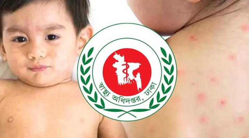 হাম উপসর্গে ঝরে গেল আরো ৯ শিশুর প্রাণ, আক্রান্ত ১৩৪১